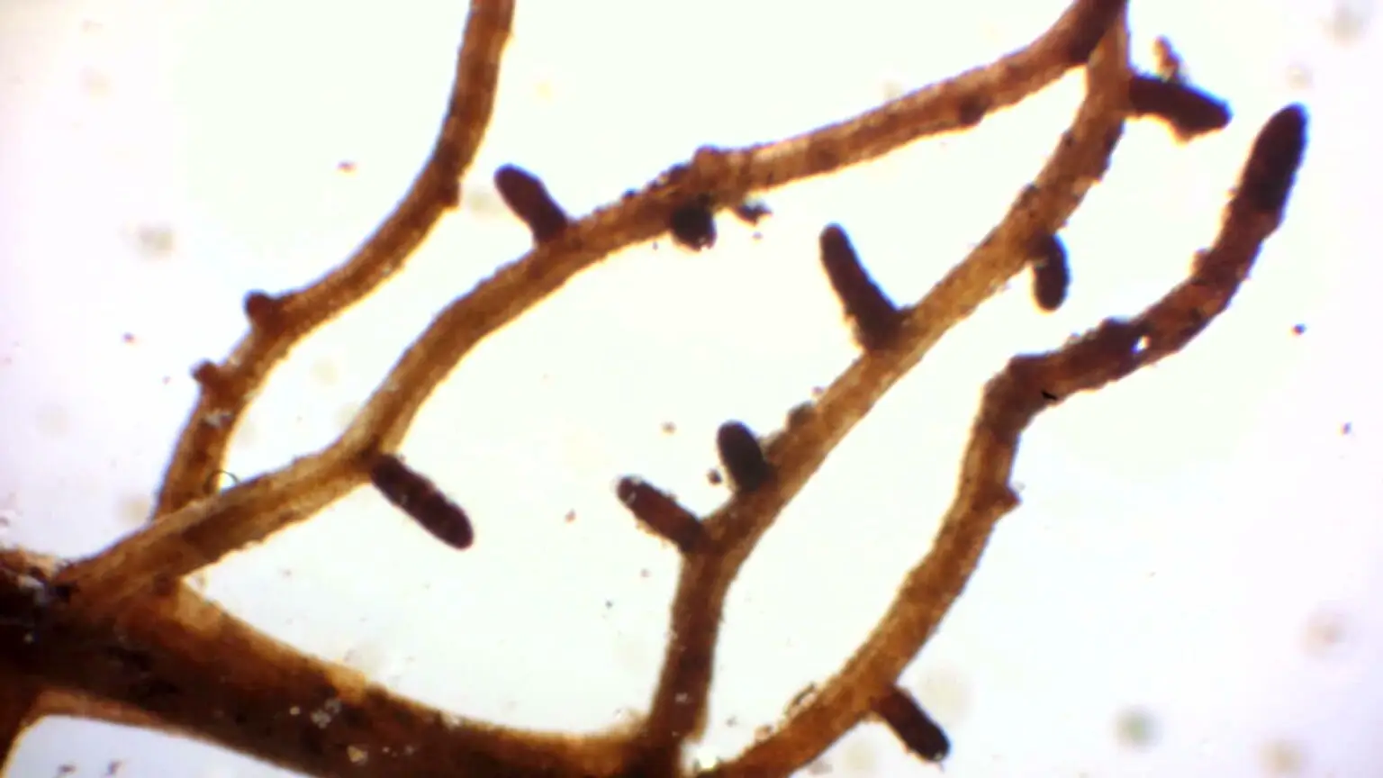 Mykorrhiza Trüffelbaum 